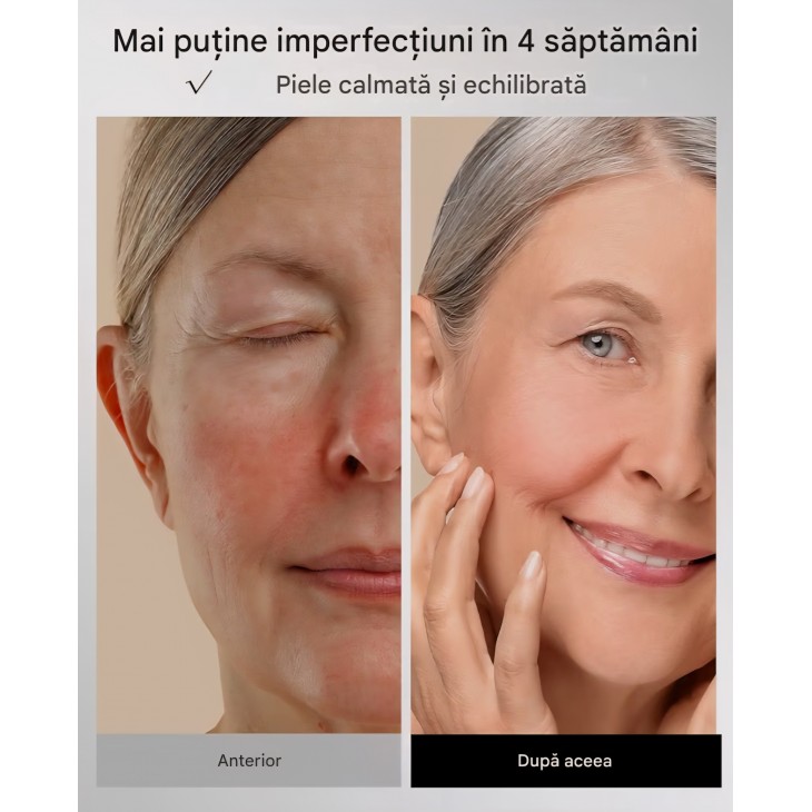 Mască facială LED INIA pentru terapie cu lumină, 4 moduri, lumină roșie, albastră și NIR 850 nm, 220 LED-uri, baterie reîncărcabilă 2600 mAh, anti-aging, termen livrare 7-8 zile