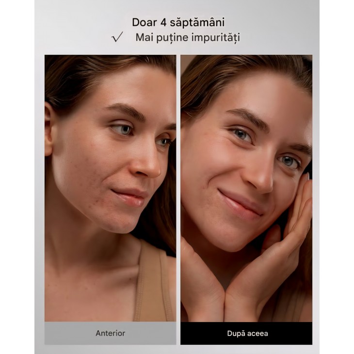 Mască facială LED INIA pentru terapie cu lumină, 4 moduri, lumină roșie, albastră și NIR 850 nm, 220 LED-uri, baterie reîncărcabilă 2600 mAh, anti-aging, termen livrare 7-8 zile