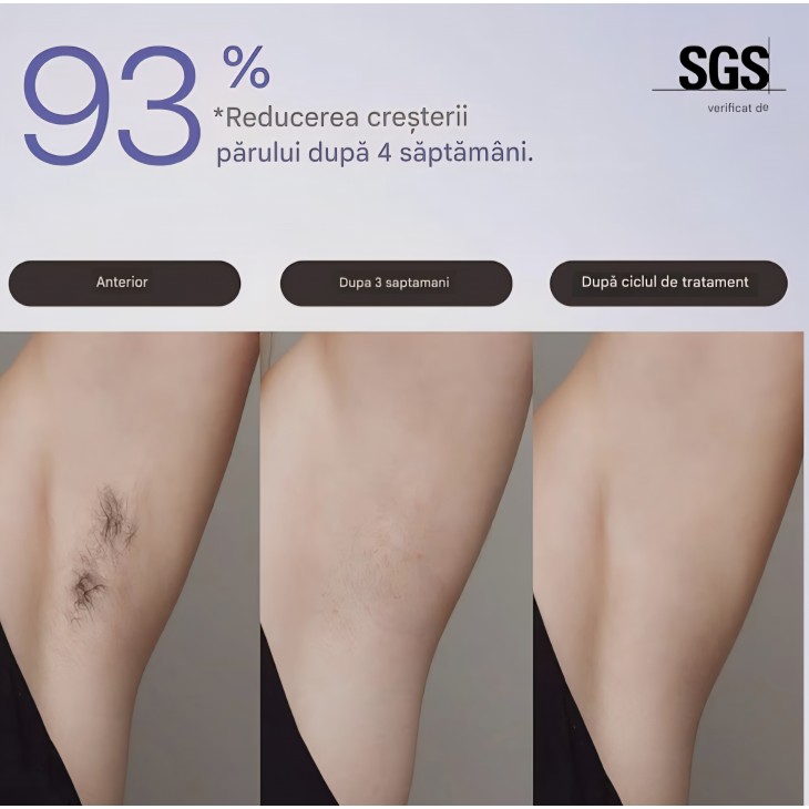 Epilator IPL Ulike Air 3, pentru față și corp, cu sistem Sapphire Ice Cooling, epilare nedureroasă, rezultate de lungă durată, mov, livrare 8-9 zile