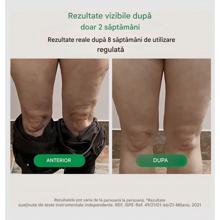 Dispozitiv masaj anticelulitic TESMED, cu role convergente și divergente, pentru fermitatea și netezirea pielii, roz, livrare 7-9 zile