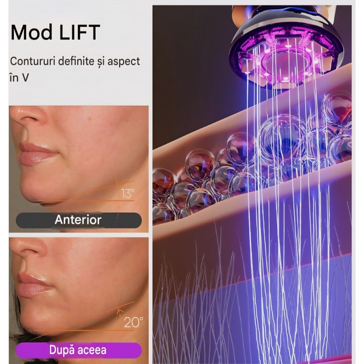 Aparat Profesional, INIA FLARE, masaj facial cu microcurenți și lumină roșie, dispozitiv 3-în-1 pentru față și gât cu funcție de incălzire, ajută la reducerea vizibilă a umflăturilor și ridurilor, termen livrare 7-8 zile