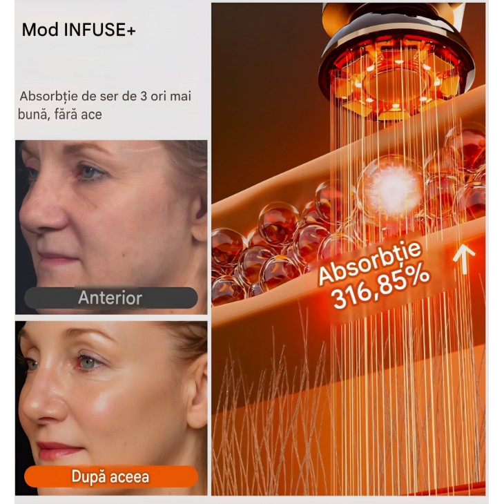Aparat Profesional, INIA FLARE, masaj facial cu microcurenți și lumină roșie, dispozitiv 3-în-1 pentru față și gât cu funcție de incălzire, ajută la reducerea vizibilă a umflăturilor și ridurilor, termen livrare 7-8 zile
