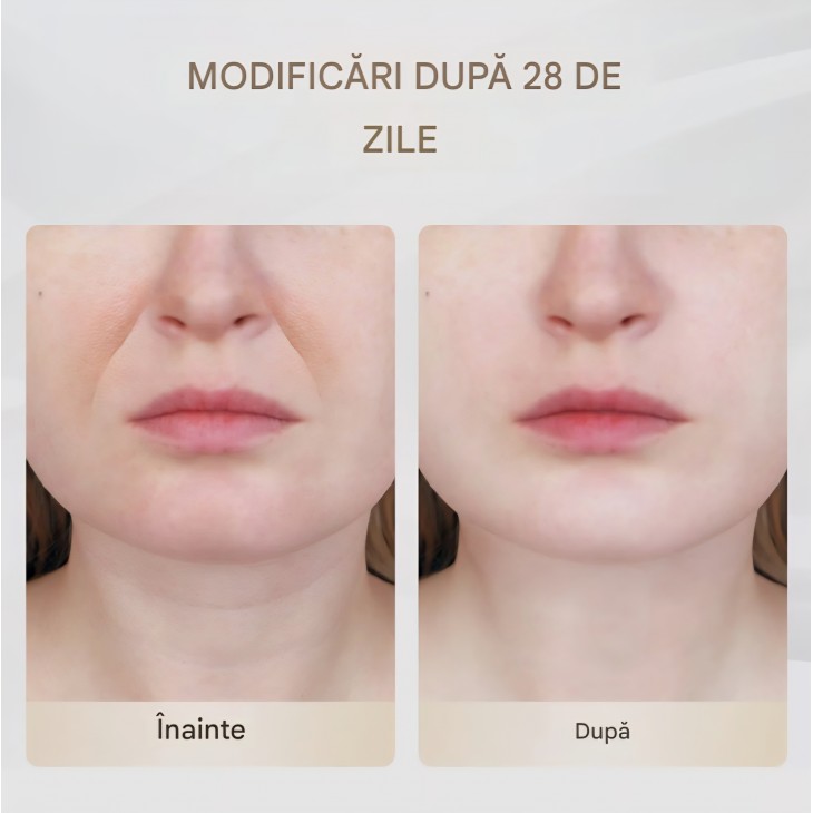 Aparat Masaj Facial ANLAN cu 3 Moduri, Incalzire pana la 45°C, Dispozitiv Beauty pentru Ingrijirea si Confortul Pielii, pentru Femei si Barbati, termen livrare 7-8 zile